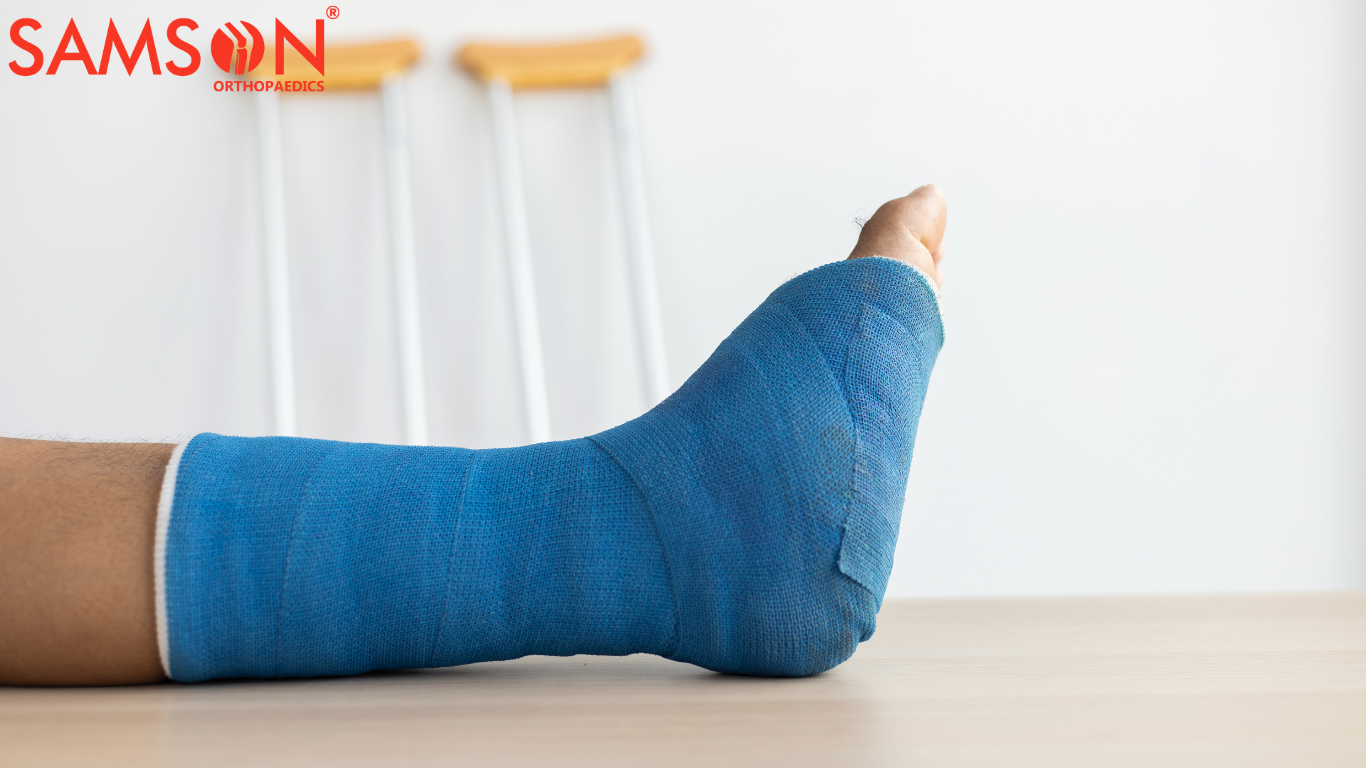 Finding the Right Foot Drop Brace: Top Solutions for Comfort, Support, and Stability