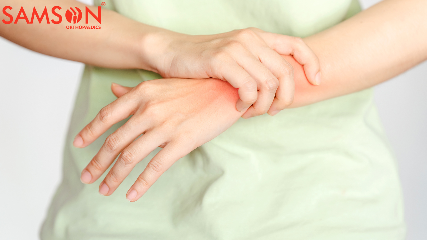 4 Early Symptoms of Wrist/Hand Arthritis and What to Do - SAMSON ...