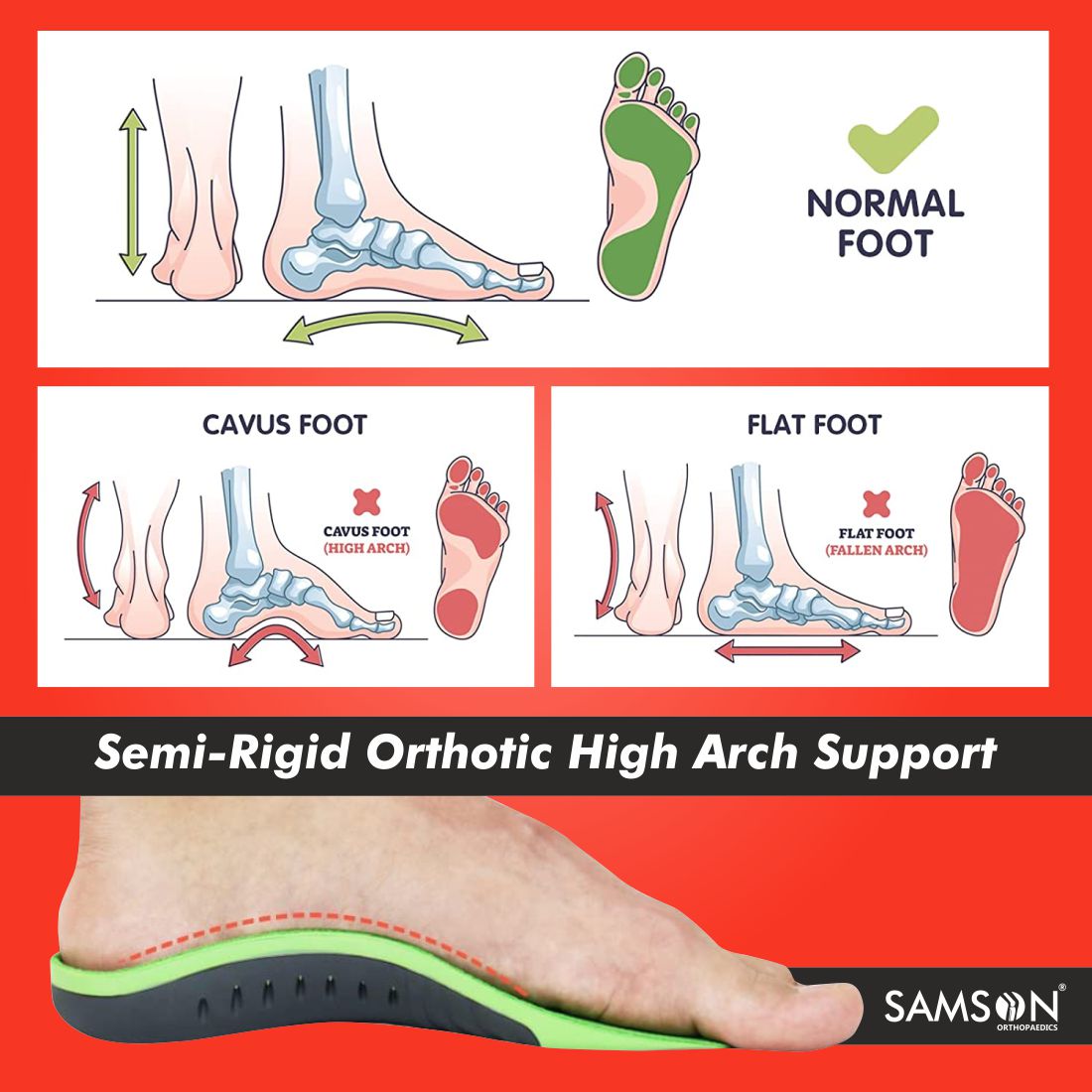 3/4 Orthotic Insole with Arch Support