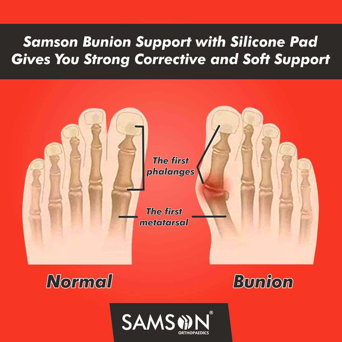 Bunion Support with Silicone Pad (Pair)